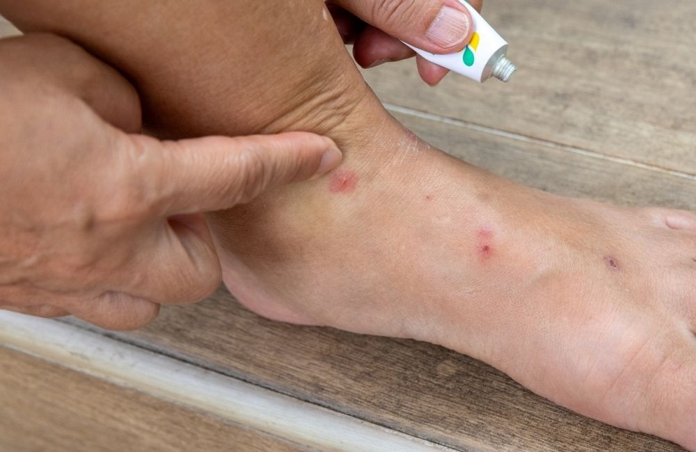 家裡有跳蚤一定要用跳蚤藥嗎?什麼情況才需要?